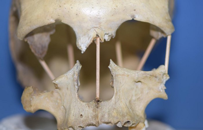 Skull & Bones entra em alfa após oito anos de problemas no desenvolvimento,  diz reportagem