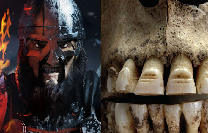 Vikings Filed Their Teeth For Unknown Reasons