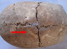 Skull with traces of healed trauma (the arrow) from Tell Majnuna, Syria, late Chalcolithic (c. 3500 BC). Photo by A. Sołtysiak