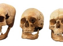 These are strong, intermediate, and non-deformed skulls (from left to right) from the Early Medieval sites Altenerding and Straubing in Bavaria, Germany. Credit: State Collection for Anthropology and Palaeoanatomy Munich