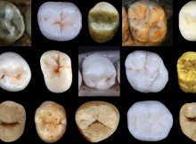 Dental morphology. Photo credit: Aida Gómez-Robles