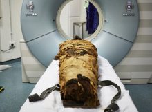 The mummified body of Nesyamun being CT scanned at Leeds General Infirmary.Courtesy of Leeds Museums and Galleries