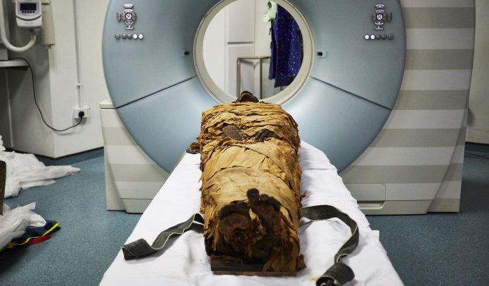 The mummified body of Nesyamun being CT scanned at Leeds General Infirmary.Courtesy of Leeds Museums and Galleries