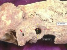 Ectocranial view of palaeopathological specimen: a) red arrow points to orifice on the mastoid process,and b) surgical preparation dimensions peripheral to trephination. Credit: Anagnostis P. Agelarakis/Adelphi University