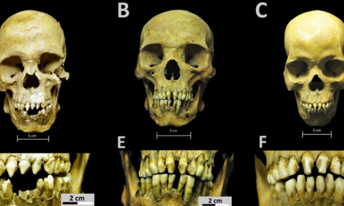 African skeletons from early colonial Mexico