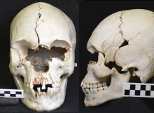 Ancient Caribbean Skull Shows Evidence Of Leprosy