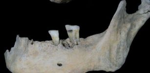 2,000-Year-Old Teeth Reveal The Diet Of An Iron Age Woman