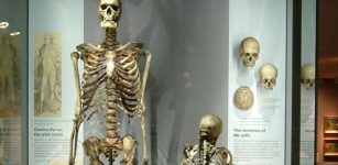 Skeleton Of Irish Giant Charles Byrne Will Not Be Displayed In The Hunterian Museum In London