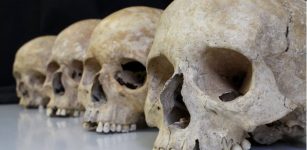 How Do Evolutionary Forces Shape The Human Skeleton?