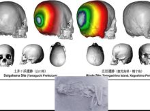 Japan's Ancient Practice Of Cranial Modification: The Case Of The Hirota People In Tanegashima