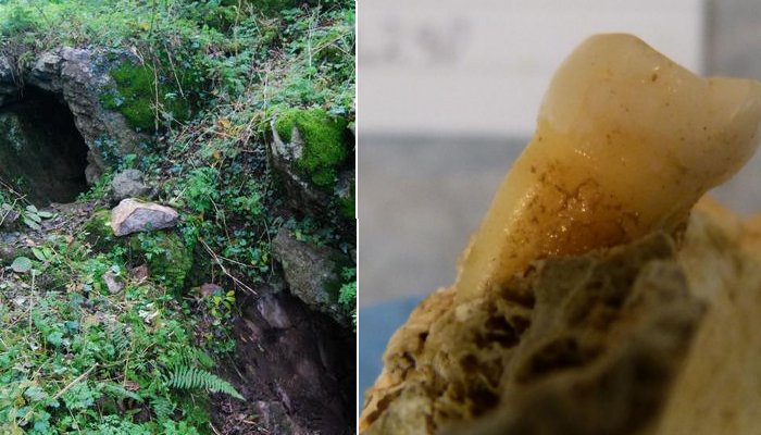 Bacteria Found In 4,000-Year-Old Human Molars Found In Cave - Responsible For Tooth Decay And Gum Disease - New Study