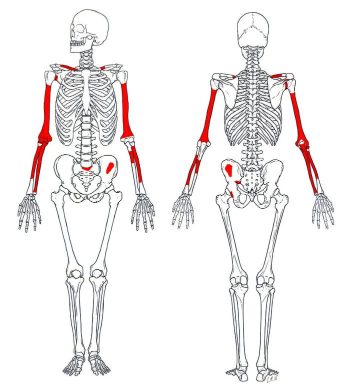 Oldest And Most Complete Skeleton Of 'Homo Habilis' Offers New Insight Into The Evolution Of Early Humans Oldest And Most Complete Skeleton Of 'Homo Habilis' Offers New Insight Into The Evolution Of Early Humans